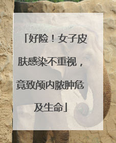 好险！女子皮肤感染不重视，竟致颅内脓肿危及生命